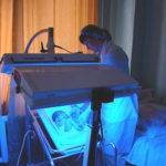 Фототерапия при желтухе у новорожденных