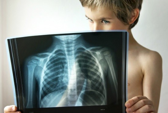 Маленьких пациентов отправляют на рентгенографию в тех случаях, когда нельзя более безопасным способом установить диагноз