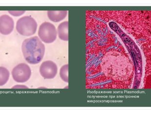 Эритроциты, зараженные Plasmodium vivax Изображение зоита Plasmodium, получе