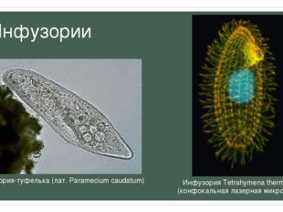 Инфузории Инфузория Tetrahymena thermophila (конфокальная лазерная микроскопи