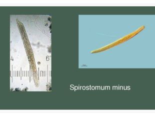 Spirostomum minus 