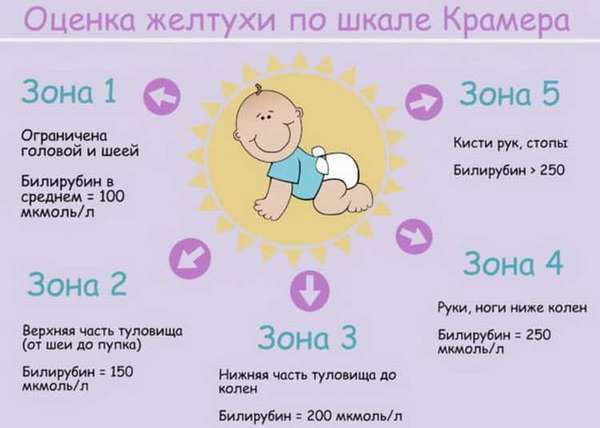Как проявляется физиологическая желтуха новорожденных