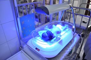 Синяя лампа при желтухе у новорожденных