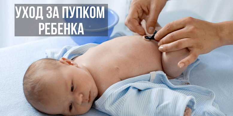 Уход за пупком ребенка